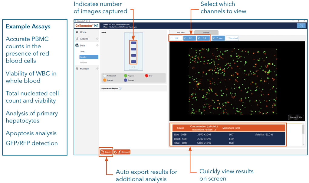 k2 matrix software screenshot