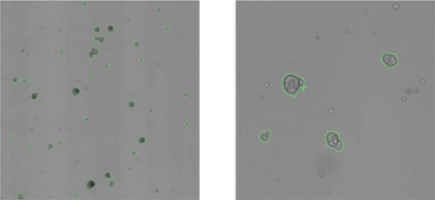 Mammosphere analysis