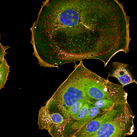 MCF7 cells