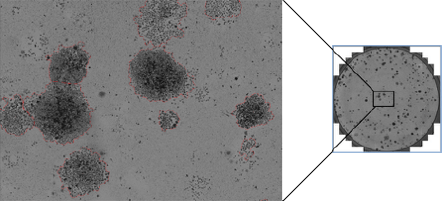 MDA MB 468 colonies stained with methylene blue