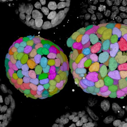MDCK cysts, nuclei segmented