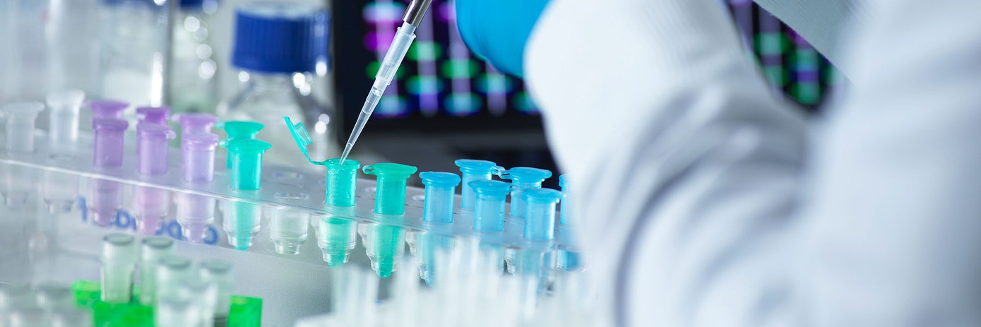 Measuring kinase activity with HTRF KinEASE assay kit