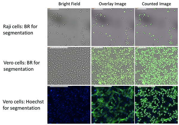 Measure zika viral titration 1