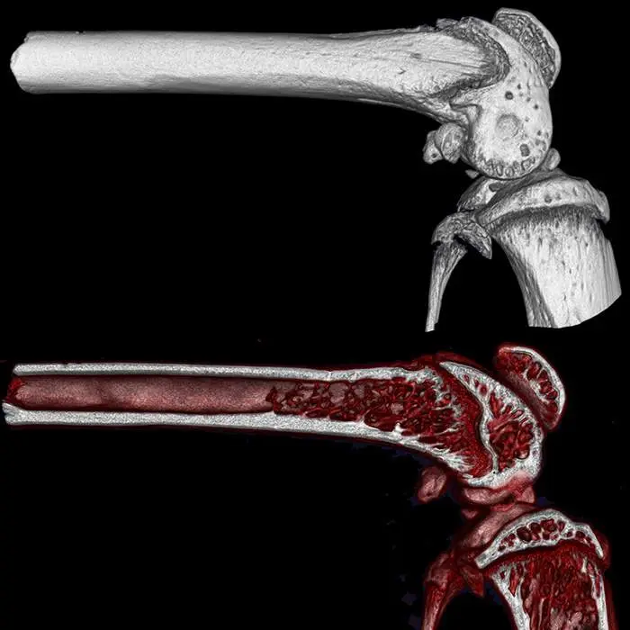 Quantum GX3 microCT cortical and trabecular scan of mouse knee