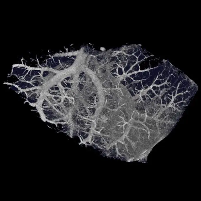 Mouse lung imaged using Quantum GX2 microCT system