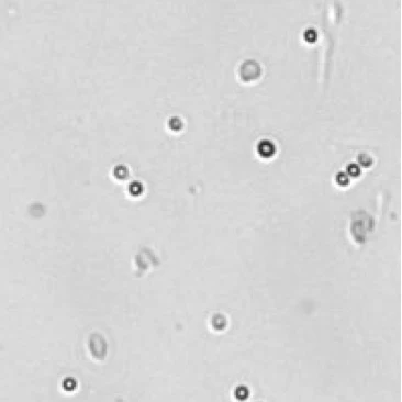 Mouse lymphotcytes 3