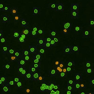 Mouse lymphotcytes 6
