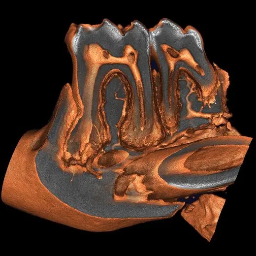 Mouse tooth showing root canals. Imaged on Quantum GX3 microCT