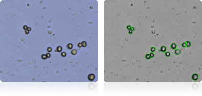 BT-549 cells