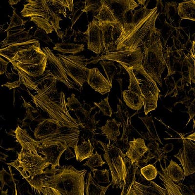 Neuroblastoma SHSY5Y cells stained with PhenoVue Fluor 555 - Phalloidin