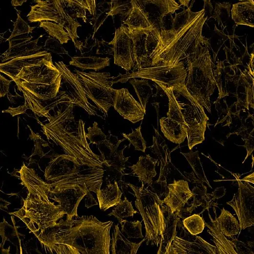 Neuroblastoma SHSY5Y cells stained with PhenoVue Fluor 555 - Phalloidin