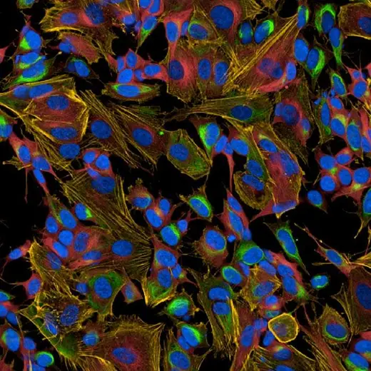 Neuroblastoma SHSY5Y cells stained with PhenoVue neuronal differentiation staining kit