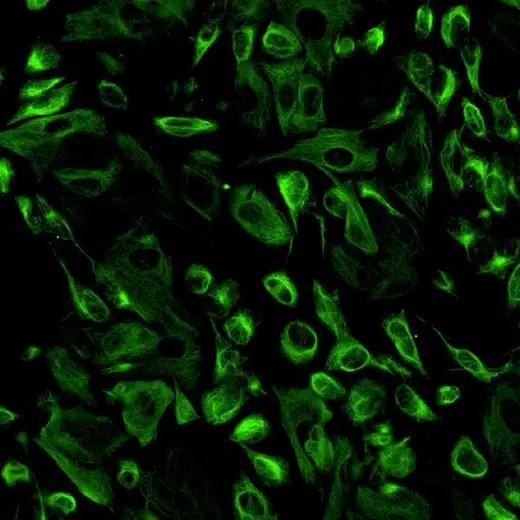 Neuroblastoma SHSY5Y cells stained with anti-Nestin antibody / PhenoVue Fluor 488 secondary antibody