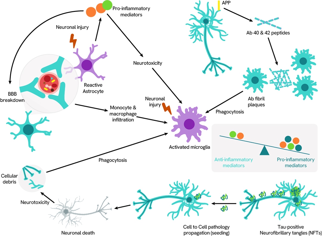 pathogenesis-alzheimer-disease-1080