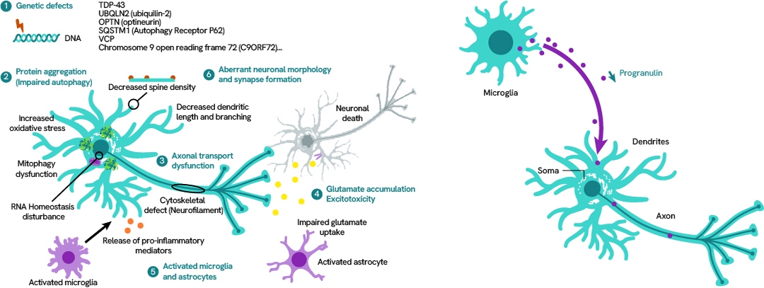 pathogenesis-amyotrophic-lateral-and-frontotemporal-dementia-1080