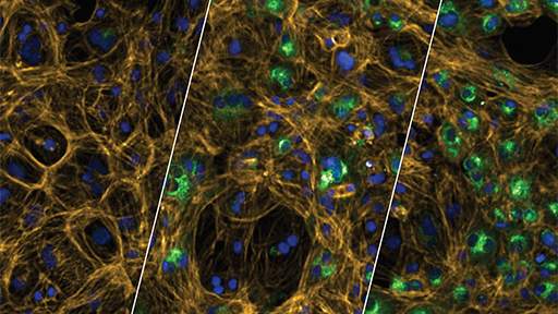 phenotypic-analysis-of-hypertrophy512