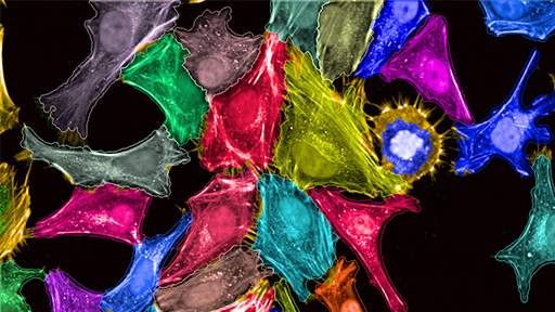 phenotypic-drug-discovery-with-hcs512