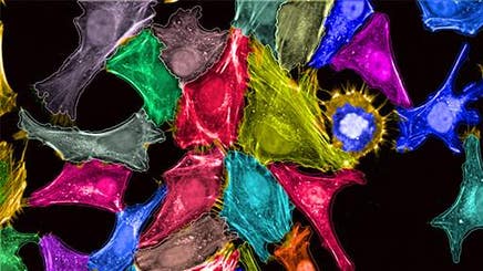 phenotypic-drug-discovery-with-hcs512