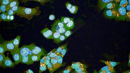 phenotypic-profiling-autophagy512x288