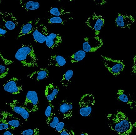 phenovue 493 lipid stain hepg2 cells