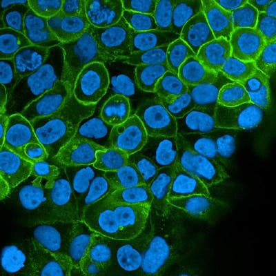 A431 cells stained with PhenoVue Fluor 488