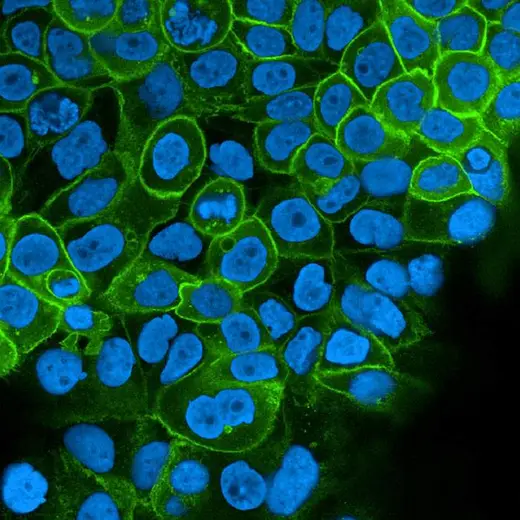A431 cells stained with PhenoVue Fluor 488