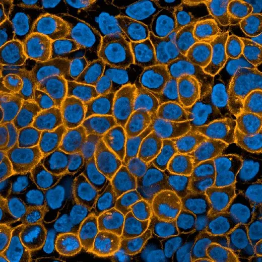 A431 cells stained with PhenoVue Fluor 555