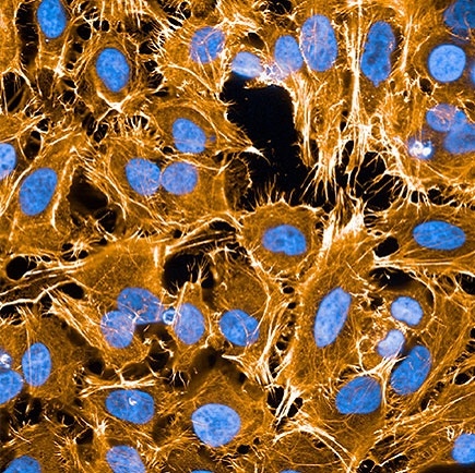 phenovue fluor 555 phalloidin hela cells