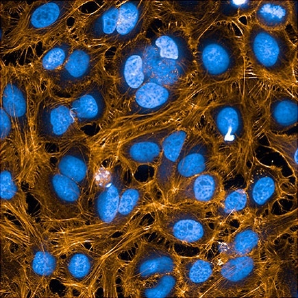 phenovue fluor 568 phalloidin hela cells