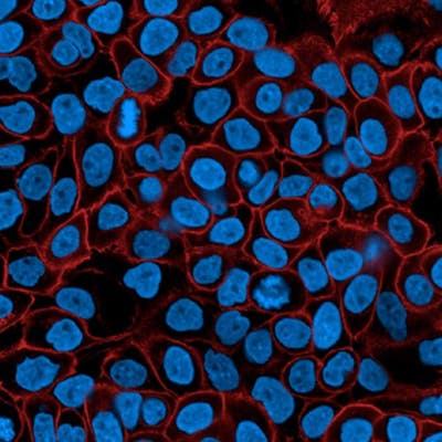 A431 cells stained with PhenoVue Fluor 594 Donkey Anti-Mouse antibody Cross-Adsorbed