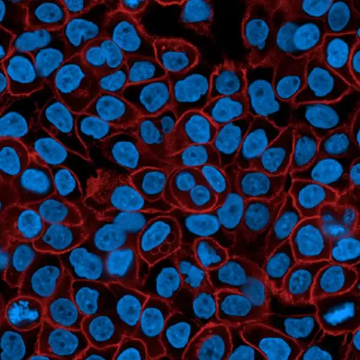 A431 cells stained with PhenoVue Fluor 594 Donkey Anti-Mouse antibody Highly Cross-Adsorbed