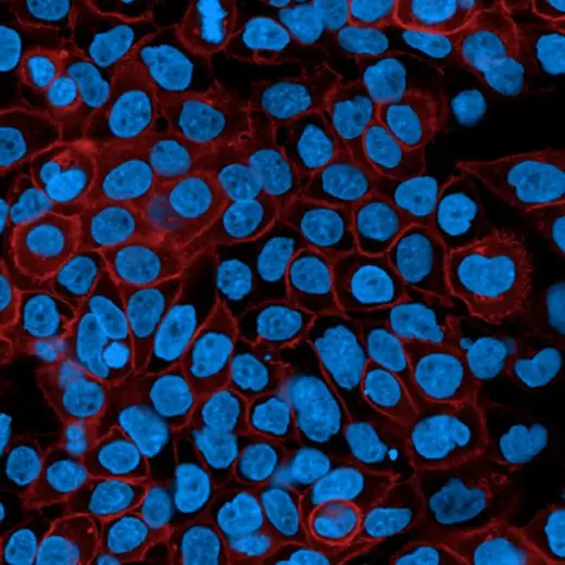 A431 cells stained with PhenoVue Fluor 594 Donkey Anti-Rabbit antibody Cross-Adsorbed