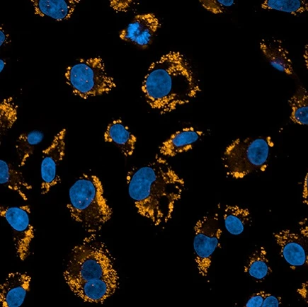 phenovue nile red lipid stain hepg2 cells