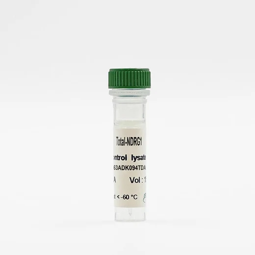 Total HER2 control lysate vial image