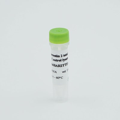 HTRF β-arrestin 2 control lysate image