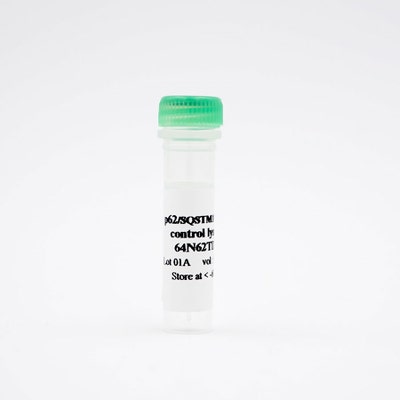 p62/SQSTM1 total control lysate image