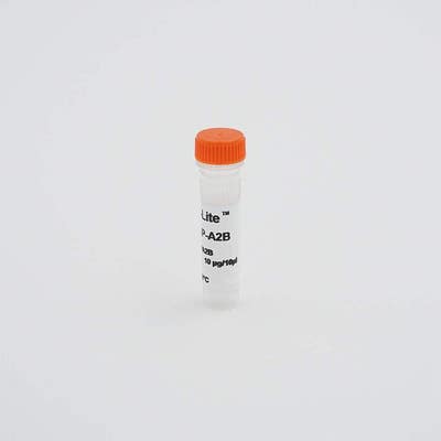 VesselVue® microbubble contrast agent, S-formulation image