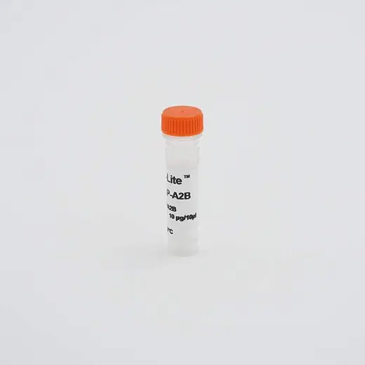 VesselVue® microbubble contrast agent, S-formulation image