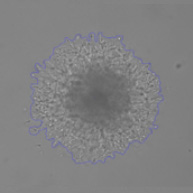 Post matrigel bright field identified spheroid