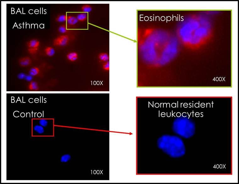 pulmonary-inflammation-fig2