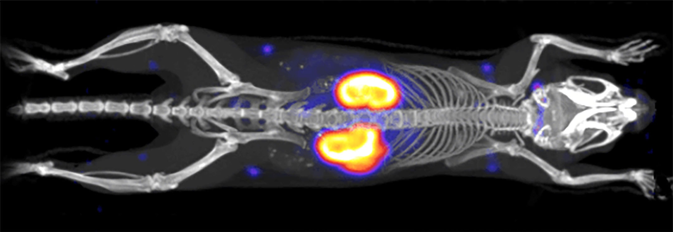 Radioimaging & Radiotherapeutics | Revvity