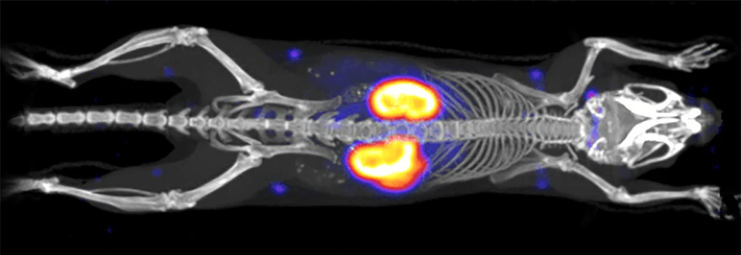 Radioimaging & Radiotherapeutics | Revvity