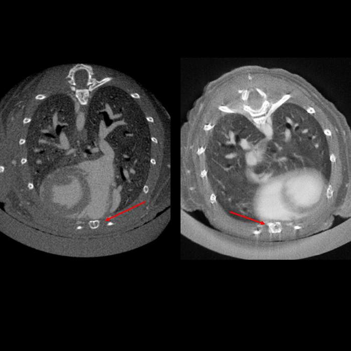 Image-based retrospective respiratory gating on Quantum GX3 microCT system