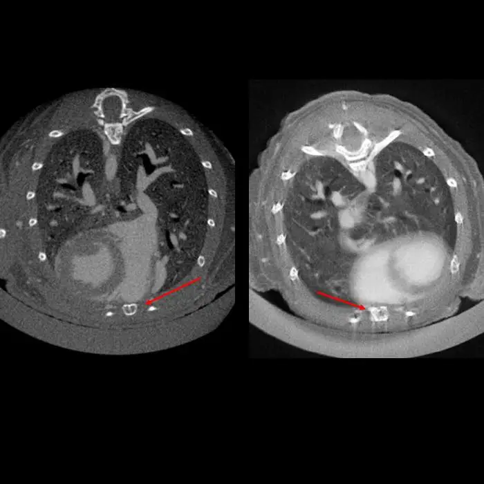 Image-based retrospective respiratory gating on Quantum GX3 microCT system