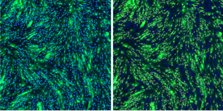 Segmentation of transduced fibroblasts