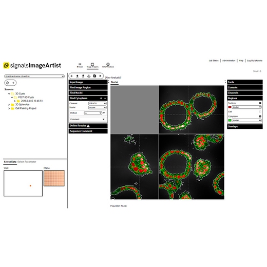 Signals Image Artist 3D Analysis