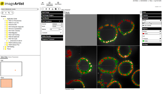 Signals Image Artist 3D Analysis