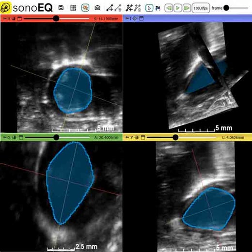 SonoEQ ultrasound acquisition & analysis software