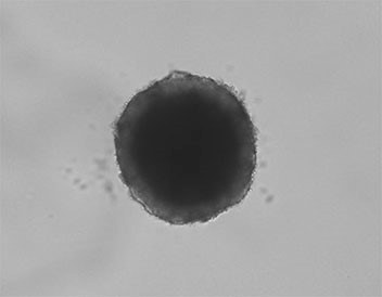 spheroid at hypoxia