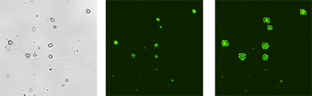 Cellometer Images of Sample 1: SVF stained with AO+PI